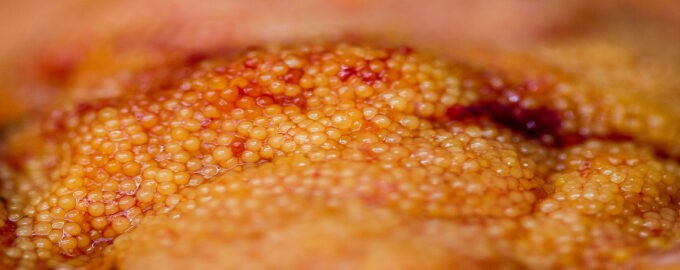 чем полезна икра сазана