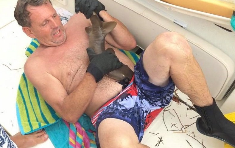 небольшая акула вцепилась в кожу